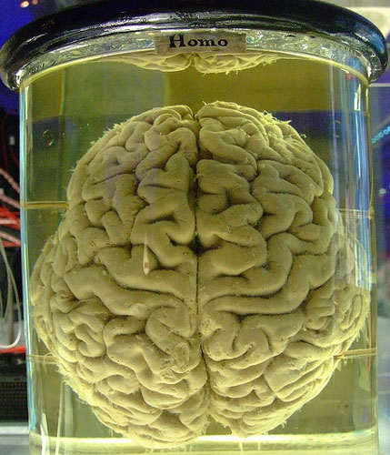参观世界最大-秘鲁大脑标本博物馆 关爱健康